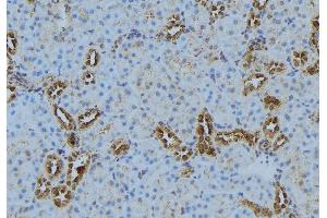 ABIN6272877 at 1/100 staining Mouse kidney tissue by IHC-P. (LPCAT1 抗体  (Internal Region))