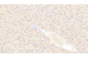 Detection of TUBa3C in Human Liver Tissue using Polyclonal Antibody to Tubulin Alpha 3C (TUBa3C) (TUBA3C 抗体  (AA 1-300))
