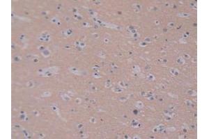 IHC-P analysis of Human Brain Tissue, with DAB staining. (PEBP1 抗体  (AA 2-187))