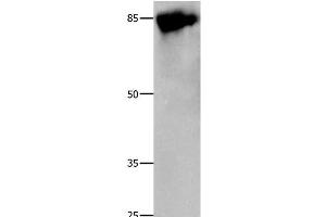 Western Blot analysis of 293T cell using Caldesmon Polyclonal Antibody at dilution of 1:800 (Caldesmon 抗体)