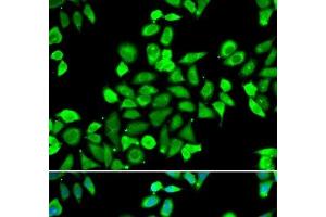 Immunofluorescence analysis of A549 cells using CDC16 Polyclonal Antibody (CDC16 抗体)
