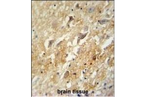 Immunohistochemistry (Paraffin-embedded Sections) (IHC (p)) image for anti-gamma-aminobutyric Acid (GABA) B Receptor, 2 (GABBR2) (AA 861-890), (C-Term) antibody (ABIN654172)