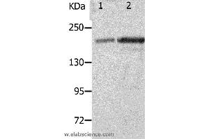 Western blot analysis of Mouse spleen and kidney tissue, using NPHS1 Polyclonal Antibody at dilution of 1:800 (Nephrin 抗体)