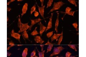 Immunofluorescence analysis of L929 cells using XPNPEP3 Polyclonal Antibody at dilution of 1:100.