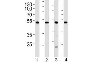 Western blot analysis of lysate from 1) human 293, 2) mouse NIH3T3, 3) rat C6 cell line and 4) mouse kidney tissue lysate using Cdk9 antibody at 1:1000. (CDK9 抗体  (AA 251-278))