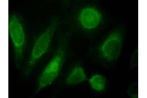Immunofluorescence testing of HeLa cells with ODZ3 antibody at 10ug/ml [green] shows staining of nuclei. (TENM3 抗体)