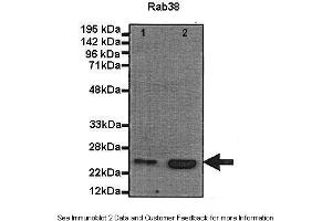 Human, Mouse (RAB38 抗体  (N-Term))