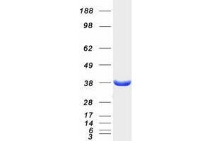 Western Blotting (WB) image for Malate Dehydrogenase 2, NAD (Mitochondrial) (MDH2) protein (Myc-DYKDDDDK Tag) (ABIN2725673)