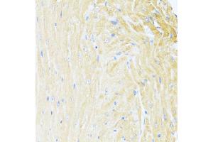Immunohistochemistry of paraffin-embedded mouse heart using UQCC2 antibody  at dilution of 1:100 (40x lens). (MNF1 抗体  (AA 14-126))