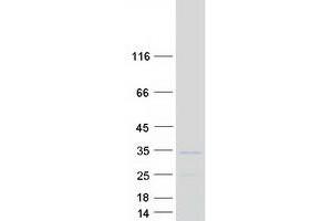 Ribosomal Protein L8 (RPL8) (Transcript Variant 1) protein (Myc-DYKDDDDK Tag)