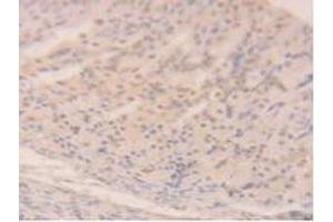 Immunohistochemistry (IHC) image for anti-Sirtuin 6 (SIRT6) (AA 1-334) antibody (ABIN7437191)
