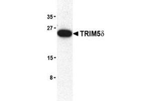 Western blot analysis of TRIM5 delta expression in mouse brain cell lysate with TRAP30953PU-N at 2 μg/ml. (TRIM5 抗体  (C-Term, Isoform delta))