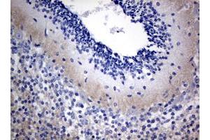 Image no. 1 for anti-Visinin-Like 1 (VSNL1) (AA 2-191) antibody (ABIN1491120) (VSNL1 抗体  (AA 2-191))