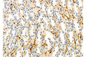 ABIN6264916 and ABIN6273158 at 1/100 staining Mouse kidney tissue by IHC-P. (SACM1L 抗体  (Internal Region))