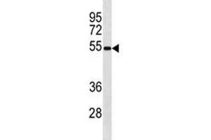 Ips-1 antibody western blot analysis in mouse spleen tissue lysate. (MAVS 抗体  (AA 1-30))
