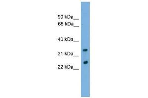 CHMP4B antibody used at 0. (CHMP4B 抗体  (Middle Region))