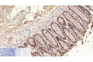 Immunohistochemistry of paraffin-embedded Human colon tissue using GAPDH Monoclonal Antibody at dilution of 1:200. (GAPDH 抗体)