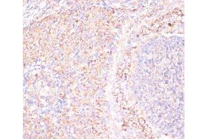 Immunohistochemistry (Paraffin-embedded Sections) (IHC (p)) image for anti-ATP Synthase, H+ Transporting, Mitochondrial F1 Complex, alpha Subunit 1, Cardiac Muscle (ATP5A1) antibody (ABIN7010884)