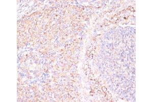 Immunohistochemistry of paraffin-embedded Rat ovary using ATP5A1 Polyclonal Antibody at dilution of 1:100 (40x lens). (ATP5A1 抗体)