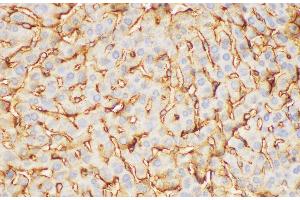 Immunohistochemistry of paraffin-embedded Mouse liver using FGB Polycloanl Antibody at dilution of 1:200 (Fibrinogen beta Chain 抗体)