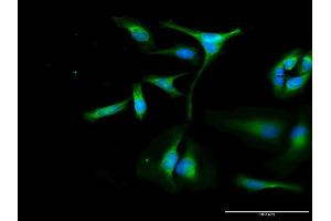 Immunofluorescence of purified MaxPab antibody to OXA1L on HeLa cell. (OXA1L 抗体  (AA 1-435))