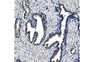 IHC analysis of PCK2 using anti-PCK2 antibody (ABIN7599509). (PEPCK 抗体  (AA 1-640))