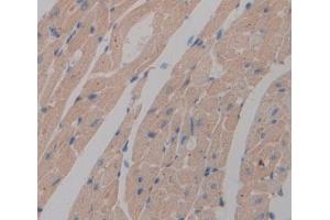 IHC-P analysis of heart tissue, with DAB staining. (NT5C 抗体  (AA 12-200))