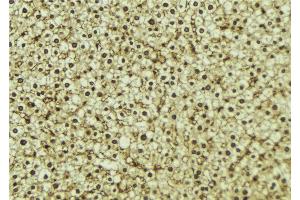 ABIN6273295 at 1/100 staining Mouse liver tissue by IHC-P. (PHF17 抗体  (C-Term))