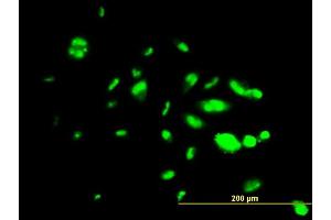 Immunofluorescence of monoclonal antibody to FOXA1 on HepG2 cell. (FOXA1 抗体  (AA 367-472))