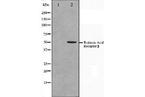 Western blot analysis on HepG2 cell lysate using Retinoic Acid Receptor beta Antibody,The lane on the left is treated with the antigen-specific peptide. (Retinoic Acid Receptor beta 抗体  (Internal Region))