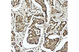 IHC analysis of SFPQ using anti-SFPQ antibody (ABIN7603089). (SFPQ 抗体  (Middle Region))