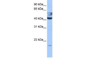 QTRT1 antibody used at 0. (QTRT1 抗体)