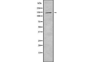 Western blot analysis of KIF4B using HepG2 whole cell lysates (KIF4B 抗体  (C-Term))