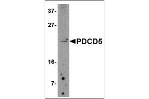 Western blot analysis of PDCD5 in Jurkat cell lysate with this product at 2.