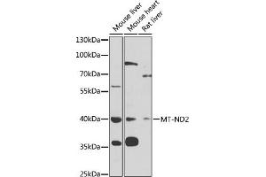 Western blot analysis of extracts of various cell lines, using MT-ND2 antibody (ABIN6135113, ABIN6144107, ABIN6144108 and ABIN6221773) at 1:1000 dilution. (MT-ND2 抗体  (AA 50-150))