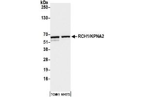 Western Blotting (WB) image for anti-Importin Subunit alpha-1 (KPNA2) (C-Term) antibody (ABIN7453571) (Importin Subunit alpha-1 (KPNA2) (C-Term) 抗体)