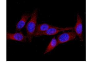 IF analysis of MID1 using anti-MID1 antibody (ABIN6719400).