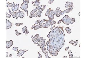 IHC analysis of ATX2/ATXN2 using anti-ATX2/ATXN2 antibody (ABIN3043507). (Ataxin 2 抗体  (C-Term))