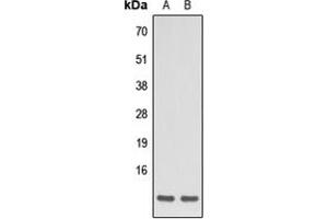 Western blot analysis of Apelin expression in HEK293T (A), HeLa (B) whole cell lysates. (Apelin 抗体  (C-Term))