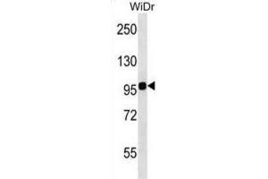Western Blotting (WB) image for anti-Integrin beta 7 (ITGB7) antibody (ABIN2998522) (Integrin beta 7 抗体)