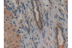 Immunohistochemistry (IHC) image for anti-Plasminogen Activator, Urokinase Receptor (PLAUR) (AA 13-114) antibody (ABIN7431179)