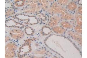 IHC-P analysis of Human Kidney Tissue, with DAB staining. (CACYBP 抗体  (AA 2-228))