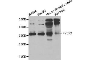 Western blot analysis of extracts of various cell lines, using PYCR1 antibody. (PYCR1 抗体)