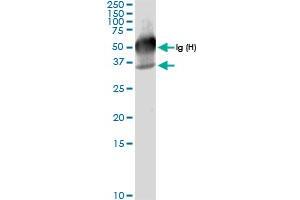 Immunoprecipitation of GALE transfected lysate using anti-GALE MaxPab rabbit polyclonal antibody and Protein A Magnetic Bead , and immunoblotted with GALE MaxPab rabbit polyclonal antibody (D01) . (GALE 抗体  (AA 1-348))