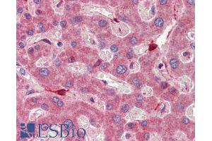 ABIN185365 (5µg/ml) staining of paraffin embedded Human Liver. (RBP1 抗体  (C-Term))