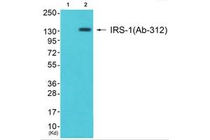 Western Blotting (WB) image for anti-Insulin Receptor Substrate 1 (IRS1) (Ser312) antibody (ABIN1848113) (IRS1 抗体  (Ser312))