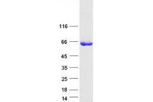 Validation with Western Blot
