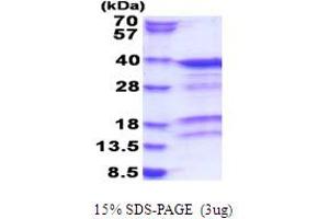 SDS-PAGE (SDS) image for Retinoblastoma Binding Protein 6 (RBBP6) (AA 1-313) protein (His tag) (ABIN5853828) (RBBP6 Protein (AA 1-313) (His tag))