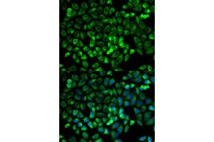 Immunofluorescence (IF) image for anti-Tryptase alpha/beta 1 (TPSAB1) antibody (ABIN1875186) (TPSAB1 抗体)