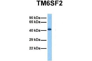 Host:  Rabbit  Target Name:  TM6SF2  Sample Tissue:  Human Fetal Liver  Antibody Dilution:  1. (TM6SF2 抗体  (C-Term))